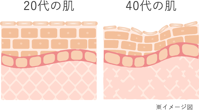 肌断面