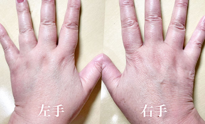 白無垢美容液を塗った左手と塗ってない右手