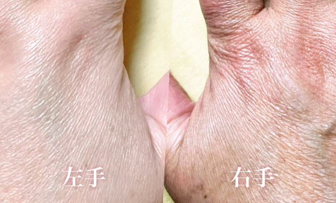 白無垢美容液を塗った左手と塗ってない右手