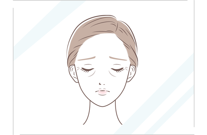 しわたるみが目立つ女性