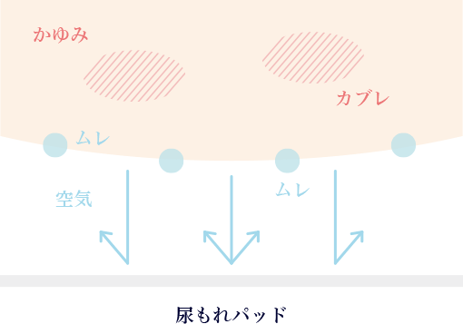 市販のナプキン:空気が通りにくく肌がムレてかぶれやすい
